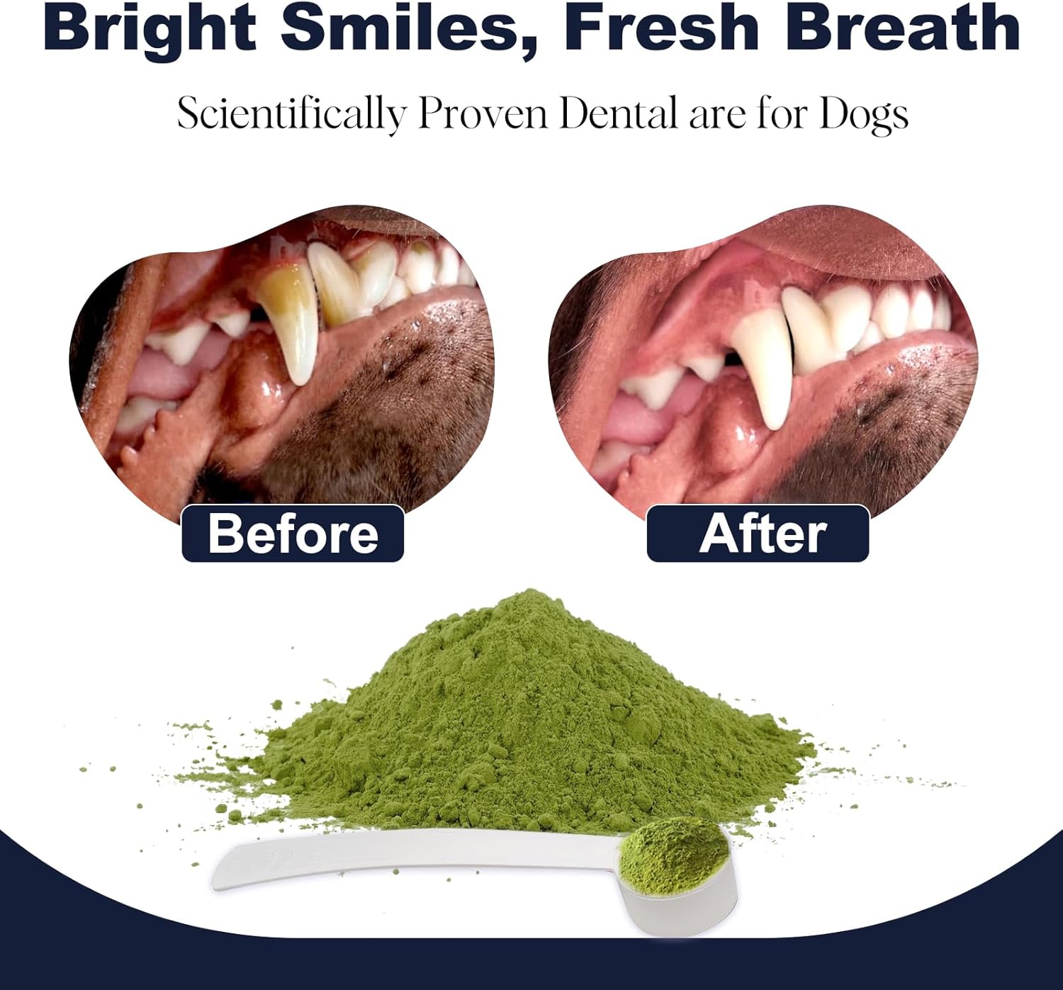 Before and after teeth